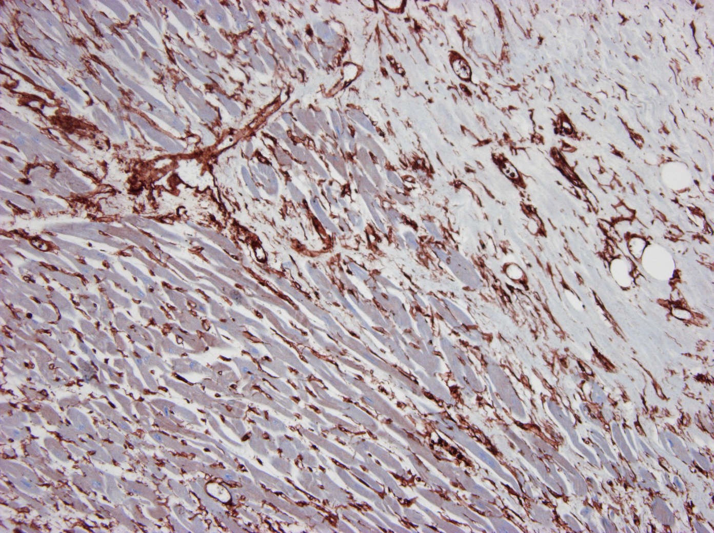 Figure 3. Formalin fixed, paraffin embedded human heart tissue immunostained for gamma cytoplasmic actin using MUB0111P (clone 2A3) at a 100x dilution.